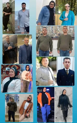 کپسول گاستریک بالن ٣٠ روزه